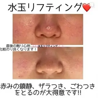 Vary まなみのエステ・リラクイメージ