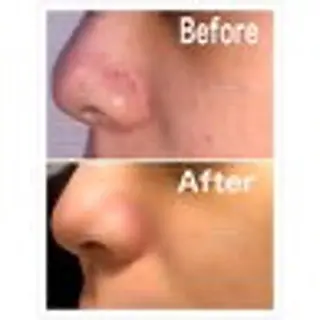 オーガニック エステ サロンフィオーレの眉毛・アイブロウイメージ