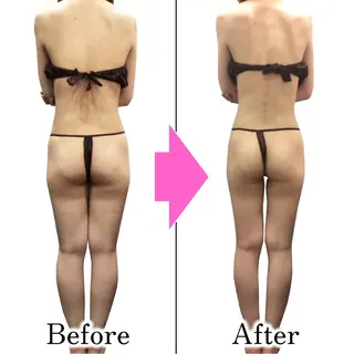 ダイエットラボ梅田店 🌟のエステ・リラクイメージ