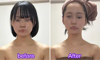 Linomalie エステ/たるみ/脱毛のエステ・リラクイメージ