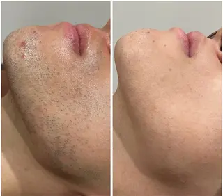 メンズ keisuke ☀️の眉毛・アイブロウイメージ