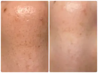 岸和田／久米田 MooMooのエステ・リラクイメージ