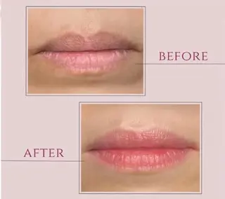 マドンナ 富士店のエステ・リラクイメージ