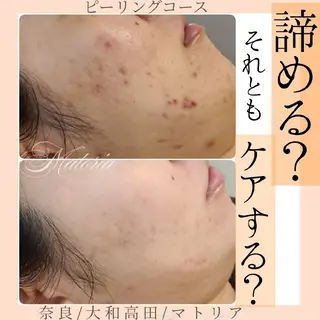 小顔 美肌専門 Matoriaのエステ・リラクイメージ