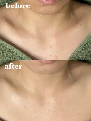 肌質改善＆脱毛 【M Mondo】のエステ・リラクイメージ