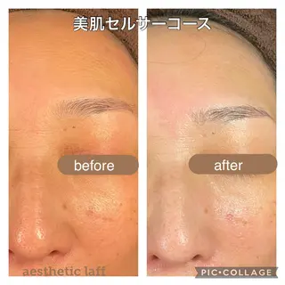 美肌作りのサロン 山村亜美のエステ・リラクイメージ