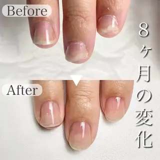 ネイル 深爪専門店 サロンリリーのネイルデザイン