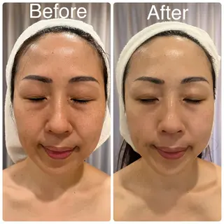 毛穴＆ホワイトニング mielのエステ・リラクイメージ