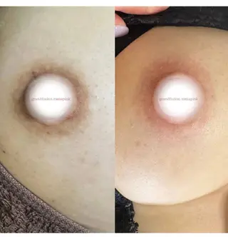 女性のお悩み美容 サロン　ヴィーナスのエステ・リラクイメージ