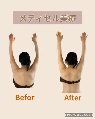 筋膜リリースサロン Embellirのエステ・リラクイメージ