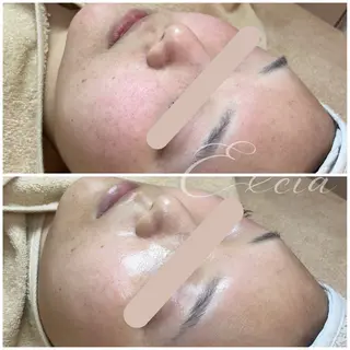 EXCIA所属・EXCIA （エクシア）のエステ・リラクイメージ