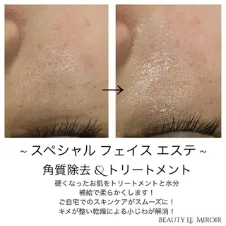 ビューティー ミロワールのエステ・リラクイメージ