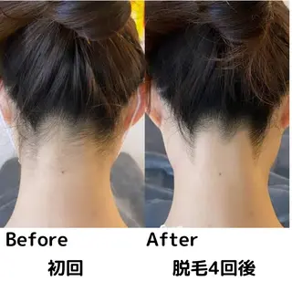 美肌脱毛サロン muroのエステ・リラクイメージ