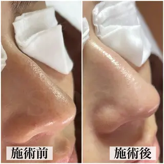 salon soso(ソソ)のエステ・リラクイメージ