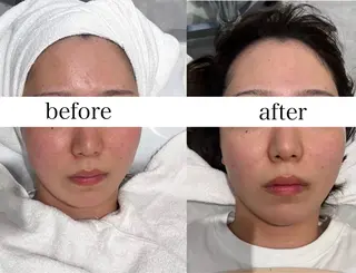 FOXYLASH inoueのエステ・リラクイメージ