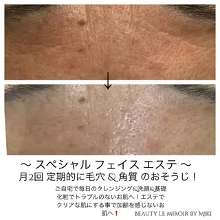 ビューティー ミロワールのエステ・リラクイメージ