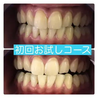 ホワイトニングルーム 横浜店のその他イメージ
