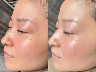 岩田 里央のエステ・リラクイメージ