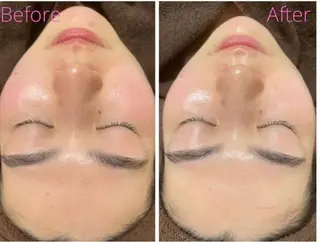 肌質改善サロン La Divinaのエステ・リラクイメージ