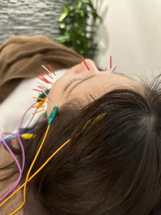 小顔矯/美容鍼/鍼灸 BeauJuのその他イメージ