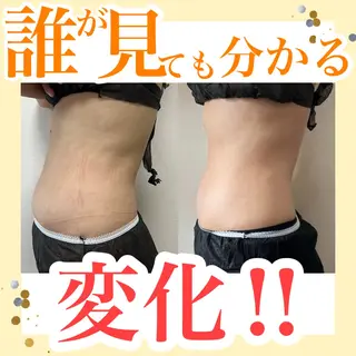 Adiy ikumiのエステ・リラクイメージ