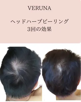 毛穴改善サロン d'Alba大阪住吉のエステ・リラクイメージ