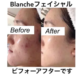 ショート カラー パーマ ヘアアレンジ キッズ ネイル マツエク・マツパ 都度払い肌質改善 &脱毛Blancheのエステ・リラクイメージ