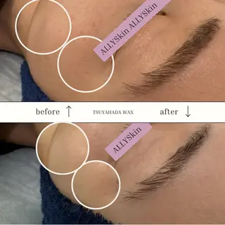 艶肌ワックス ALLY.のエステ・リラクイメージ