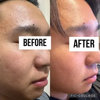 肌質改善 ×ネイルサロンのネイルデザイン