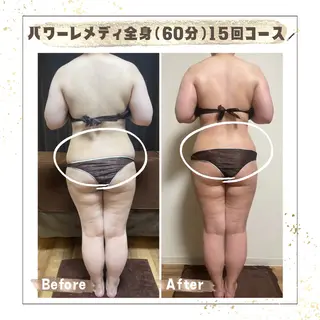 Luca 痩身× 疲労改善｜韓国肌管理のエステ・リラクイメージ