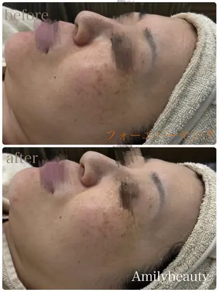 Amily beauty 毛利のエステ・リラクイメージ
