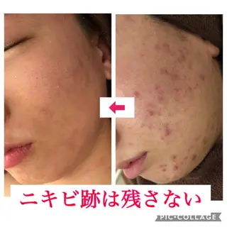 セミロング カラー パーマ ヘアアレンジ メンズ キッズ ネイル マツエク・マツパ 金の糸脱毛 産毛ケア専門のエステ・リラクイメージ