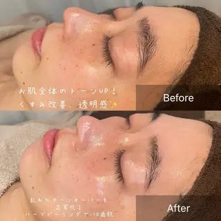 NA skin たまプラーザ　川島のエステ・リラクイメージ