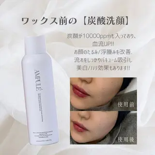 アイブロウ Lea堺東　毛穴洗浄 ×顔ワックス脱毛のその他イメージ