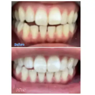 M渋谷 ホワイトニングのエステ・リラクイメージ