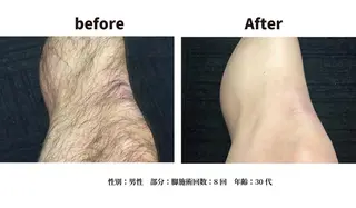 メンズ 美肌脱毛エステサロン Luangeのエステ・リラクイメージ