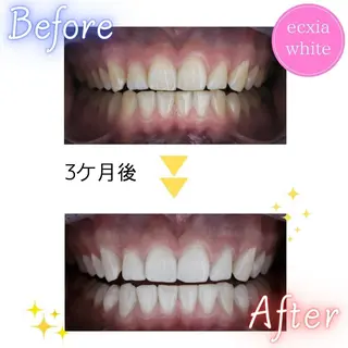 ホワイトニング rinaのその他イメージ