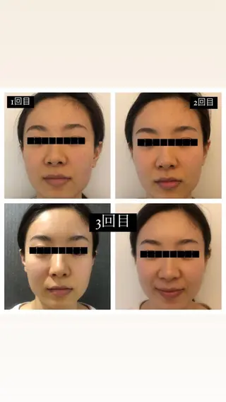 自由が丘📍 Belrougeのエステ・リラクイメージ