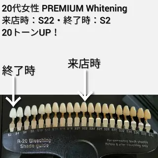 美歯口工房セルフホワイトニングMilky所属・竜沢 佳典のエステ・リラクイメージ