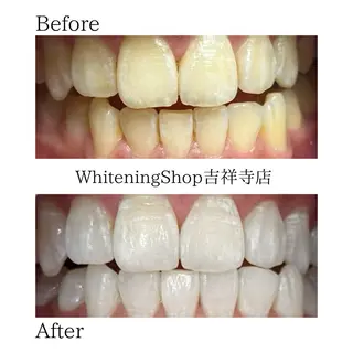 ホワイトニングショッ 吉祥寺2号店のその他イメージ