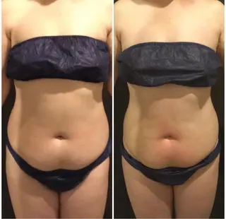 Re, Luxのエステ・リラクイメージ