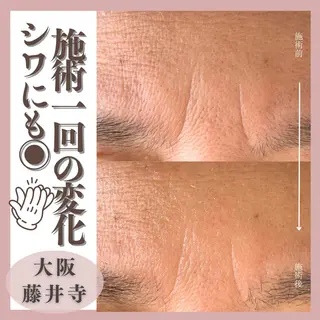 Muqu. 毛穴サロンのエステ・リラクイメージ