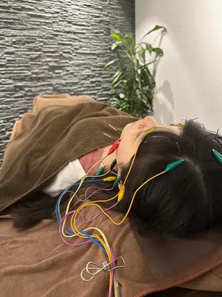 小顔矯/美容鍼/鍼灸 BeauJuのその他イメージ