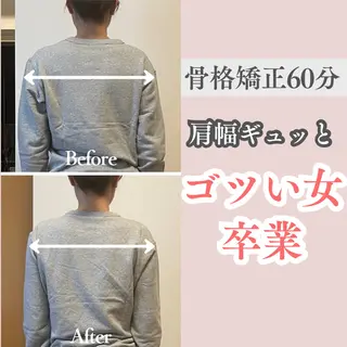 小顔矯正/骨格矯正 AKANEのエステ・リラクイメージ