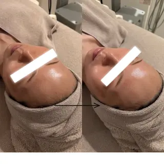 UEDA | POLA 天王寺のエステ・リラクイメージ