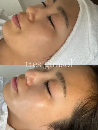 tres girasol🌻のエステ・リラクイメージ