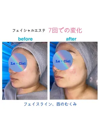 フェイシャルエステLe・Ciel所属・Le・Ciel フェイシャル&ボディのエステ・リラクイメージ
