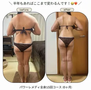 《本気痩せ×疲労改善 》  BILOOPのエステ・リラクイメージ