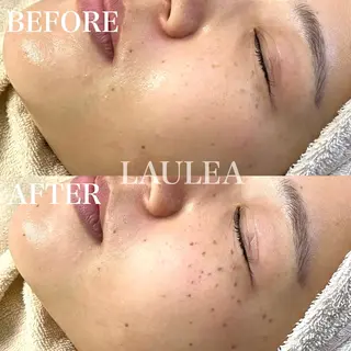 素肌をキレイに ラウレア🌼Hayaのエステ・リラクイメージ
