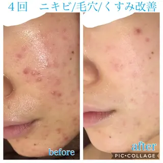 セミロング カラー パーマ ヘアアレンジ メンズ キッズ ネイル マツエク・マツパ EnsorClair 代表　野口真央のエステ・リラクイメージ